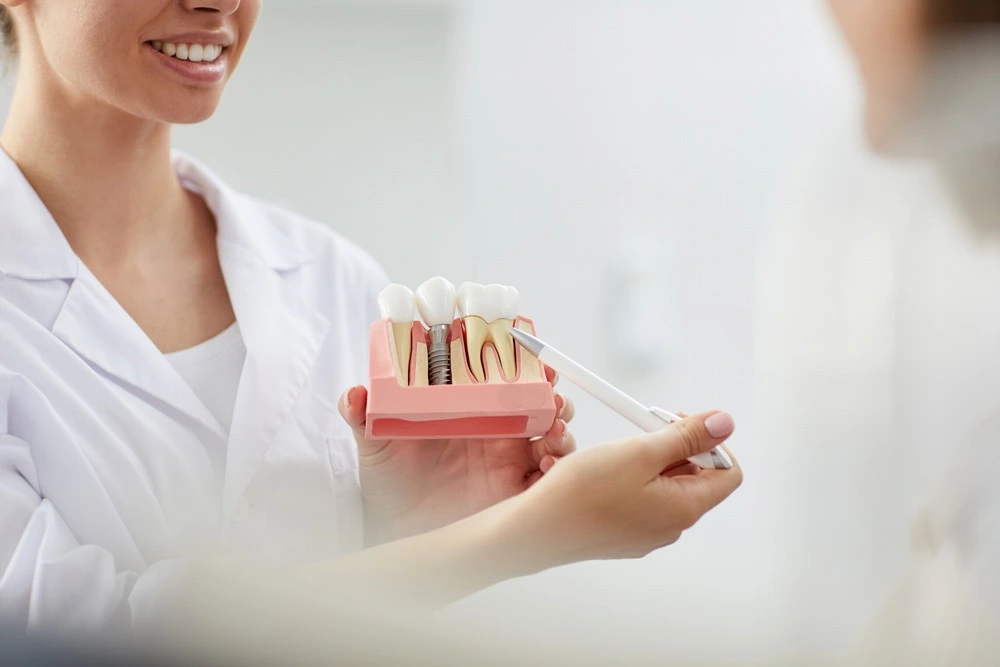 Dental İmplant